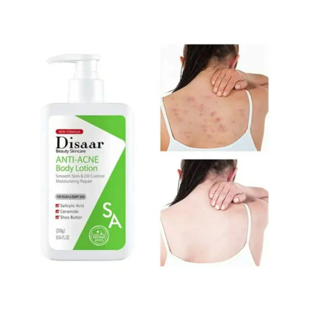 Disaar Salicylic Acid, Shea Butter & Ceramide Anti Acne Body Lotion 300g - Image 4