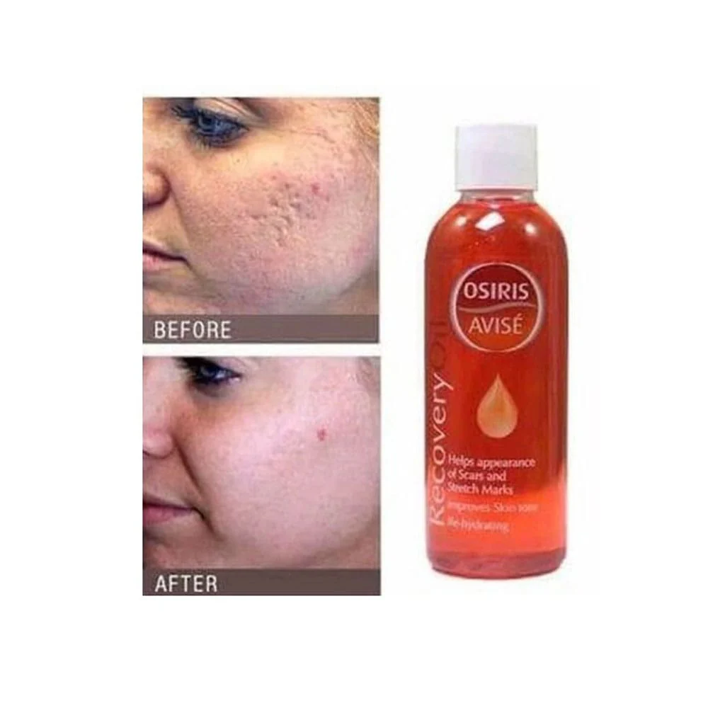 Osiris Recovery Oil 100ml - Image 3