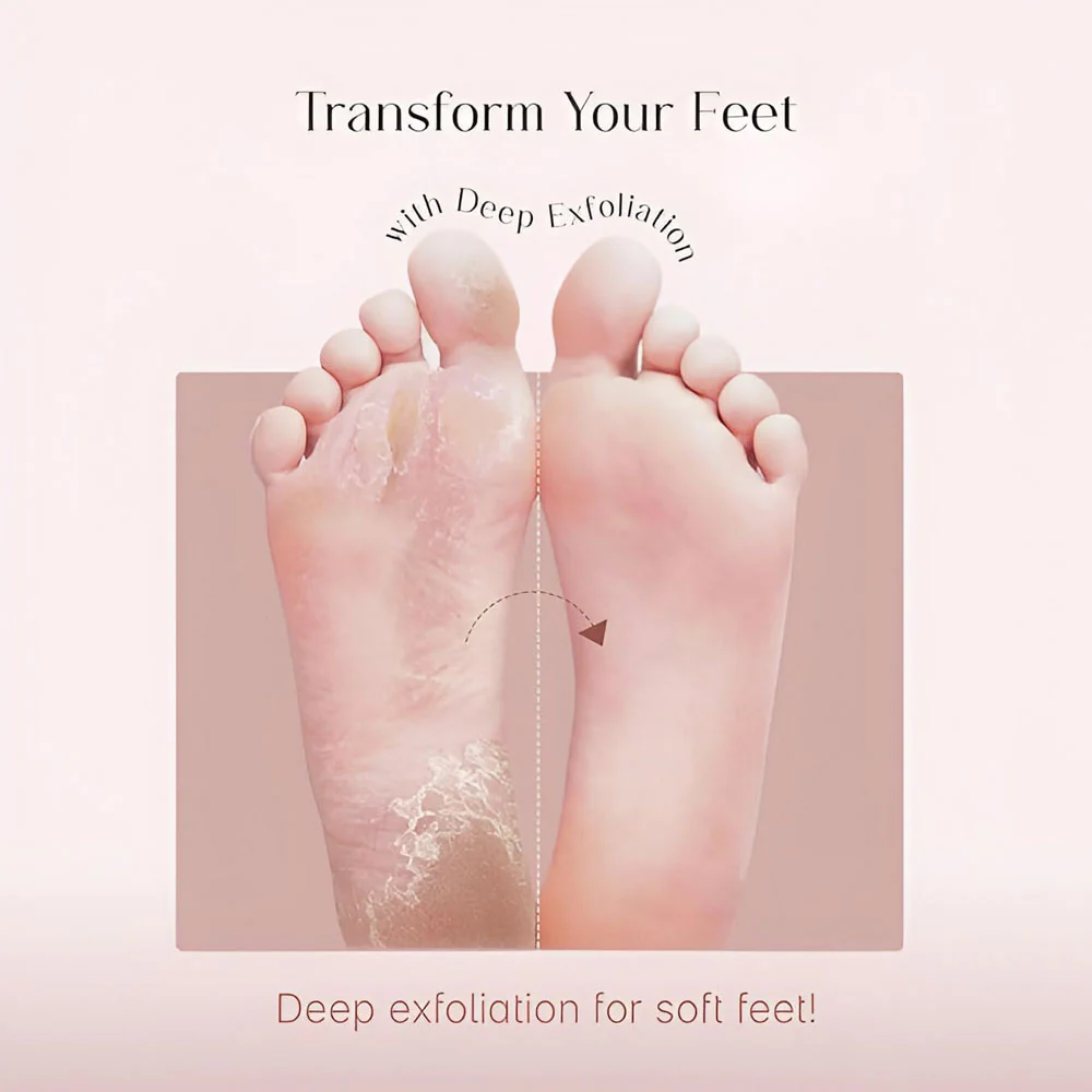 Sadoer Strawberry Nicotinamide Foot Mask 35g - Image 2