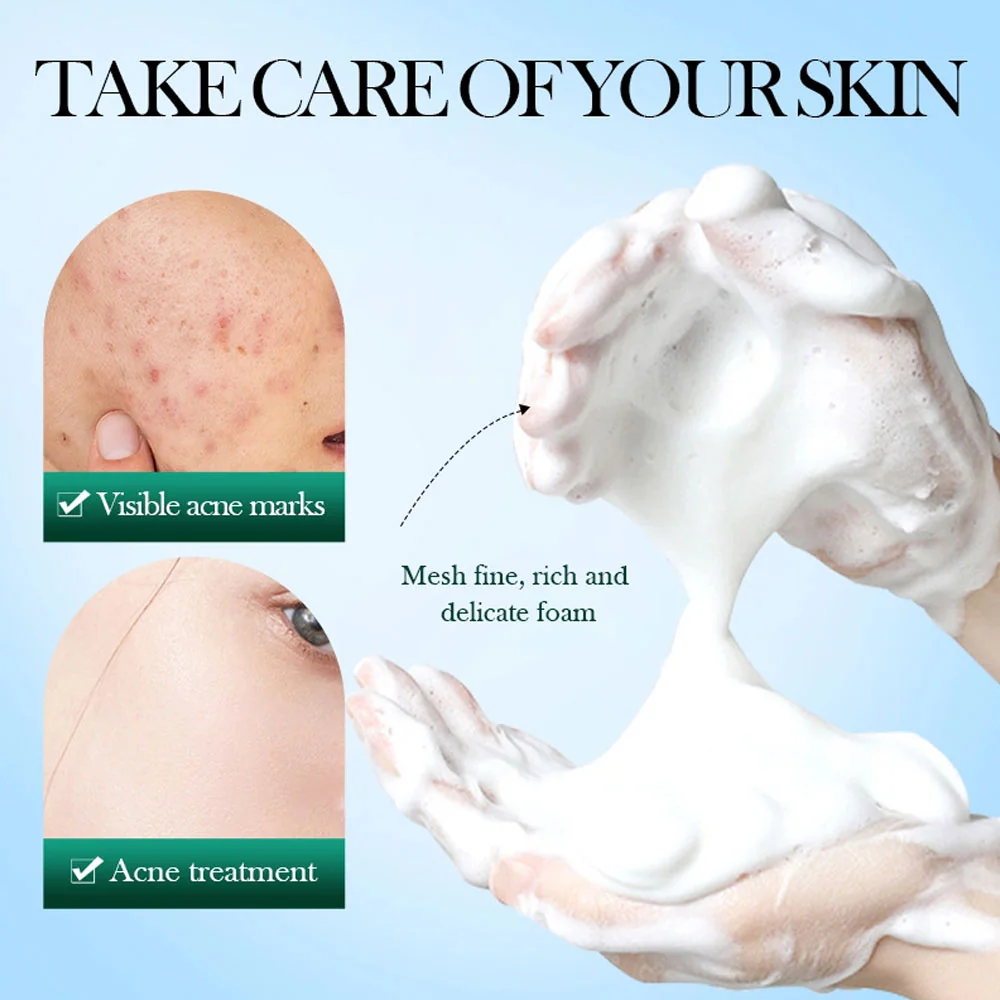 Sadoer Tea Tree Acne Oil Control Clean Mousse 150g - Image 3