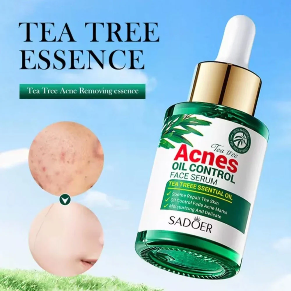Sadoer Tea Tree Acne Oil Face Serum 30ml - Image 2