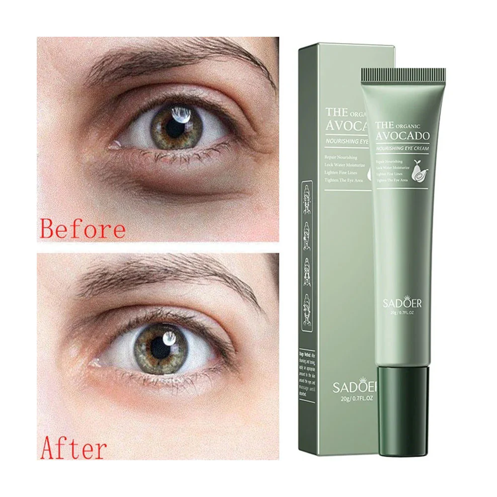 Sadoer The Organic Avocado Nourishing Eye Cream 20g - Image 2